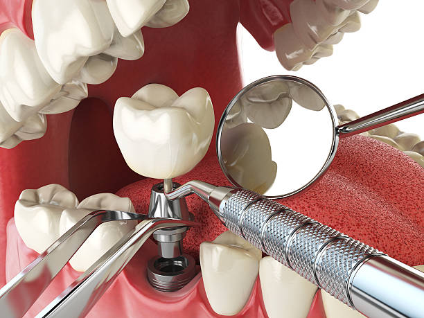 Best Cosmetic Emergency Dentistry in Watonga, OK