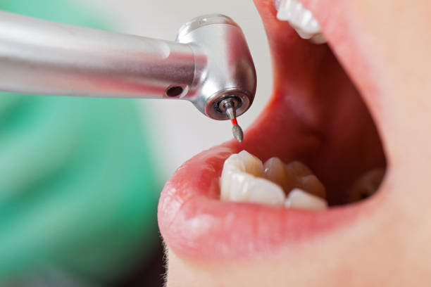 Best Emergency Dental Care for Broken or Chipped Teeth in Watonga, OK